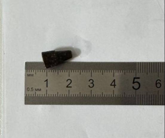 Владимирский врач извлек из бронхов мужчины колпачек от ручки 14-летней давности Владимирский врач извлек из бронхов мужчины колпачек от ручки 14-летней давности