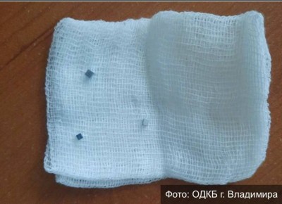 Врачи ЛОР-отделения владимирской ОДКБ спасли годовалого малыша, проглотившего магниты