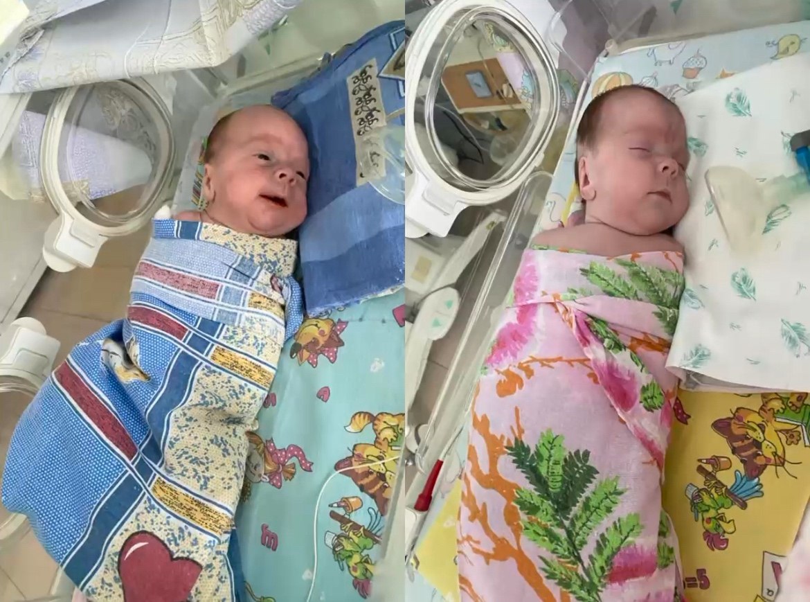 Врачи Перинатального центра спасли двойню