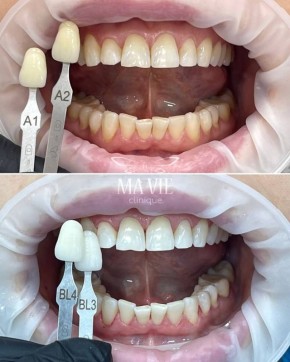 ������ ����: ��������� ���� ����� ������ � ��������