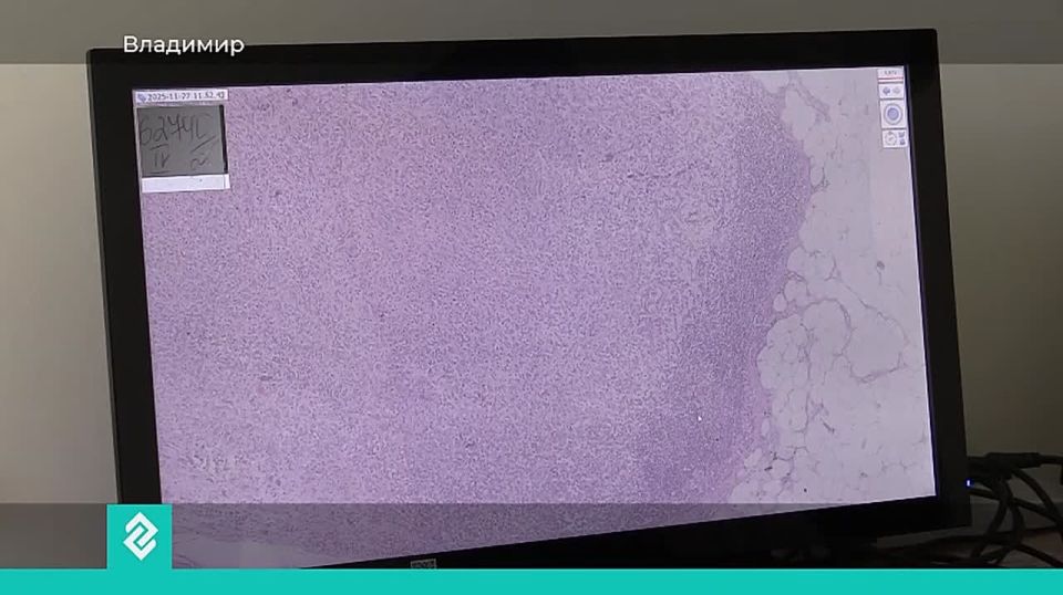 Сегодня во всем мире отмечается Международный день борьбы с онкологией